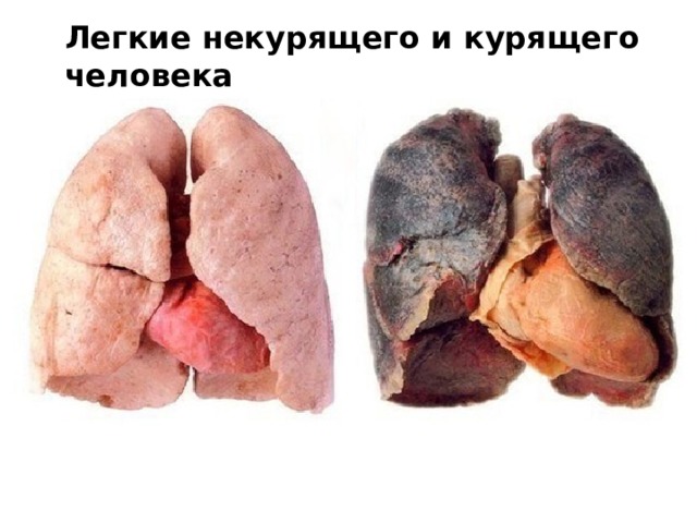 Легкие некурящего и курящего человека 