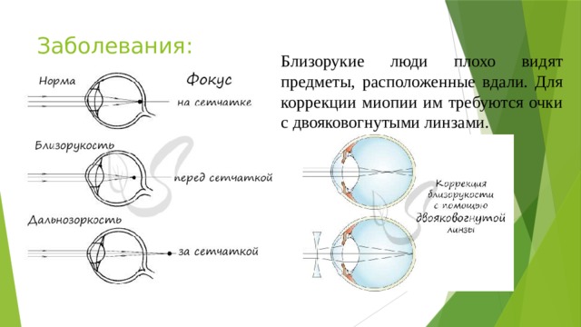 Проводниковым звеном зрительного анализатора является. Схема зрительного анализатора. Рисунок зрительного анализатора с пояснениями. Линзы зрительный анализатор. Близорукость очки двояковогнутые.