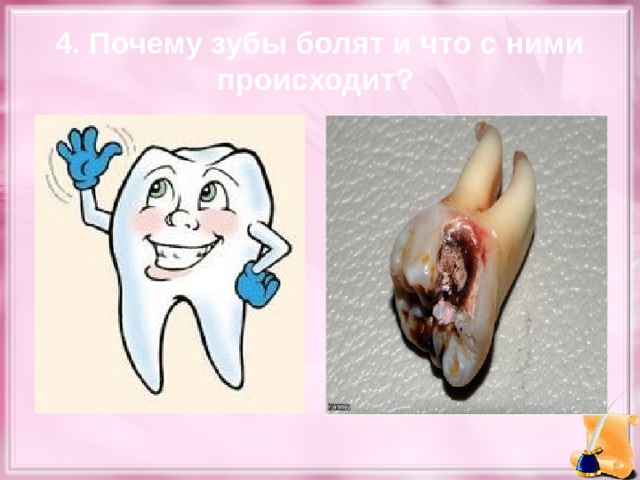 4. Почему зубы болят и что с ними происходит?  