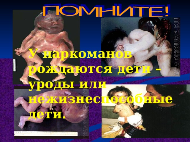   У наркоманов рождаются дети –уроды или нежизнеспособные дети. 