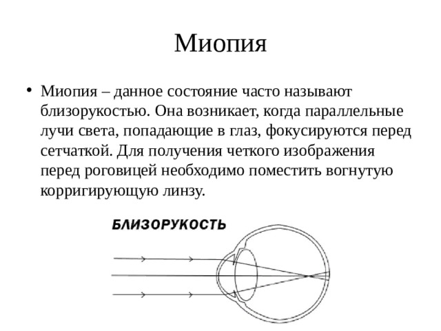 Глаз как оптическая система презентация по физике 11 класс