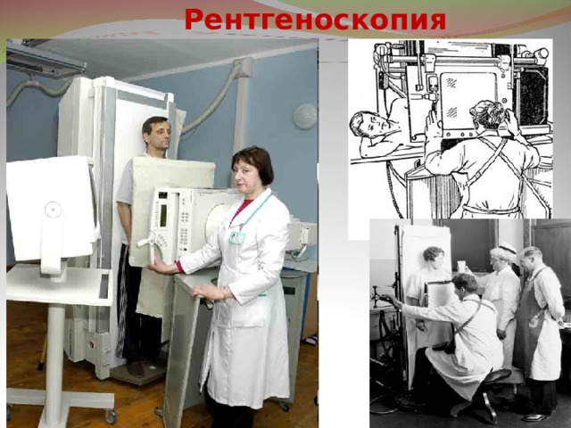 Рентгеноскопия