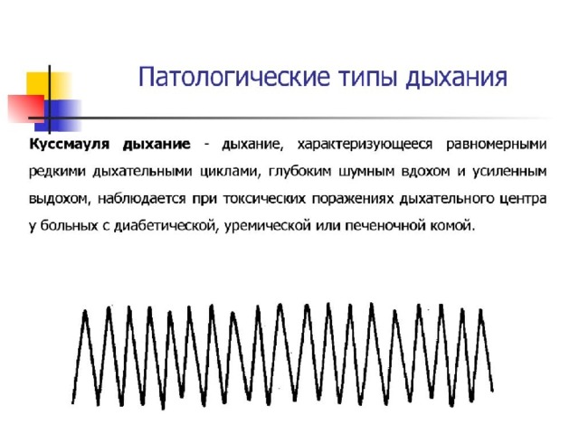 Типы дыхания картинка