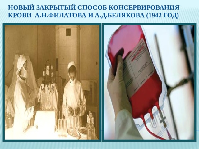 Новый закрытый способ консервирования крови А.Н.Филатова И а.д.Белякова (1942 год) 