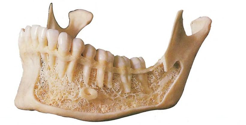 Зубы нижней челюсти. Остеопороз костной ткани альвеолярного отростка зубов. Кортикальная пластинка нижней челюсти. Остеопороз верхней челюсти. Анатомия зубов кости челюсти.