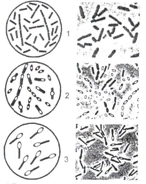 Клостридии микробиология рисунок