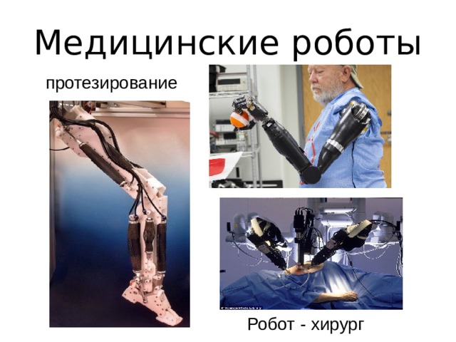 Медицинские роботы протезирование Робот - хирург  