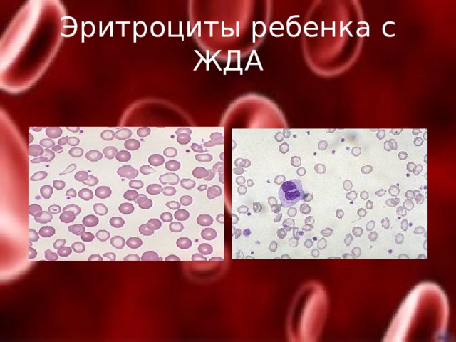 Эритроциты у ребенка в год