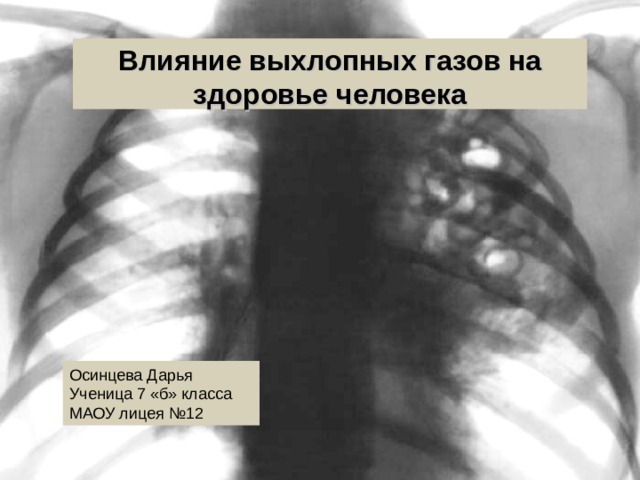 Влияние выхлопных газов на здоровье человека презентация