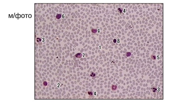м/фото.3. Мазок крови человека (окраска азуром II и эозином, малое увеличение): 1 - эритроцит; 2 - тромбоцит; лейкоциты зернистые (гранулоциты): 3 - сегментоядерный нейтрофильный гранулоцит (нейтрофил); 4 - палочкоядерный нейтрофильный гранулоцит; 5 - юный нейтрофильный гранулоцит; 6 - базофильный гранулоцит (базофил); 7 - эозинофильный гранулоцит (эозинофил); лейкоциты незернистые (агранулоциты): 8 - лимфоцит малый; 9 - моноцит  