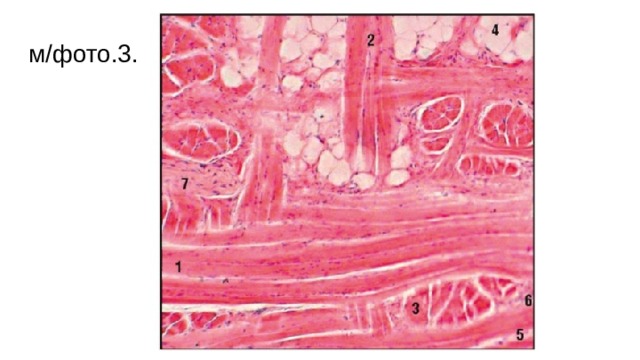 м/фото.3. Поперечнополосатая мышечная ткань языка (окраска гематоксилином и эозином): 1 - горизонтально срезанные поперечнополосатые мышечные волокна; 2 - вертикально срезанные поперечнополосатые мышечные волокна; 3 - поперечно срезанные поперечнополосатые мышечные волокна; 4 - жировые клетки; 5 - прослойки рыхлой соединительной ткани; 6 - кровеносный сосуд; 7 - нервные волокна  