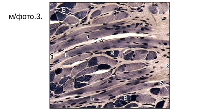 м/фото.3.  Поперечнополосатая мышечная ткань языка (окраска железным гематоксилином, большое увеличение): 1 - поперечнополосатое мышечное волокно, продольный срез: А - ядра волокна (симпласт); Б - поперечная исчерченность мышечного волокна; 2 - поперечный срез мышечного волокна: В - миофибриллы на поперечном срезе мышечного волокна; 3 - рыхлая соединительная ткань (эндомизий)  