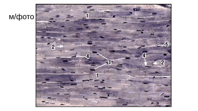 м/фото.3. Сердечная мышечная ткань (окраска железным гематоксилином): 1 - кардиомиоциты, образующие функциональные волокна; 2 - вставочные диски между кардиомиоцитами; 3 - ядро кардиомиоцита; 4 - анастомоз; 5 - кровеносный сосуд  