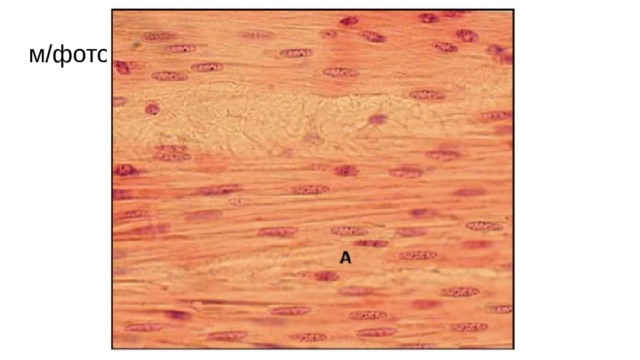 м/фото.3. Гладкая мышечная ткань на примере мышечной оболочки мочевого пузыря (окраска гематоксилином и эозином): А - продольный срез гладких миоцитов; Б - поперечный срез гладких миоцитов 