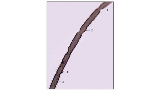  Миелиновое нервное волокно (импрегнация осмием, большое увеличение): 1 - осевой цилиндр - отросток нейрона; 2 - миелиновый (внутренний) слой оболочки нервного волокна; 3 - наружный слой оболочки нервного волокна; 4 - ядро леммоцита; 5 - узелковые перехваты (Ранвье) 