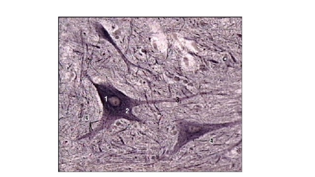  Синапсы на мотонейронах (передние рога спинного мозга), импрегнация серебром, большое увеличение: 1 - ядро с ядрышком; 2 - перикарион; 3 - отростки нейрона; 4 - синапсы на теле и отростках нейрона 