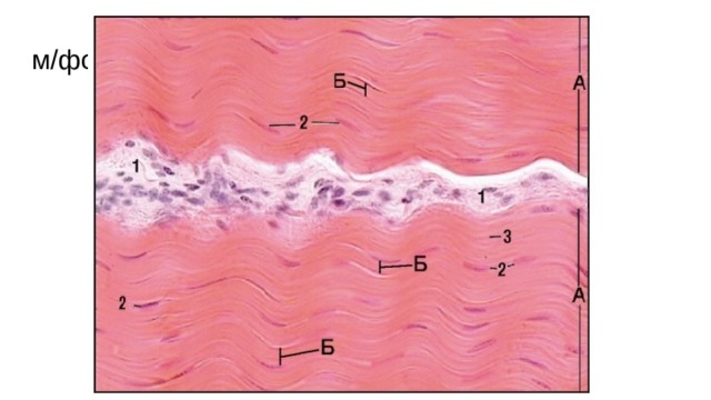 м/фото.3. Сухожилие. Плотная волокнистая оформленная соединительная ткань. Продольный срез (окраска гематоксилином и эозином, большое увеличение): А - пучок второго порядка; Б - пучок первого порядка; 1 - эндотеноний; 2 - ядра фиброцитов; 3 - коллагеновые волокна  