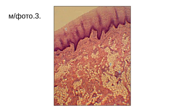 м/фото.3. Щека человека. Жировая ткань (окраска гематоксилином и эозином): 1 - многослойный плоский неороговевающий эпителий; 2 - жировая ткань; 3 - щечные слюнные железы  