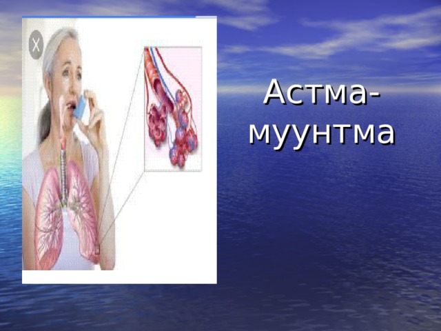Астма-муунтма 