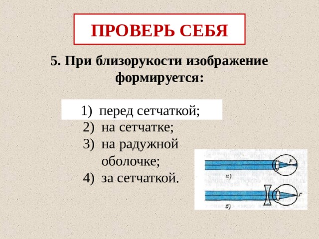 Дополните предложения изображение в близоруком