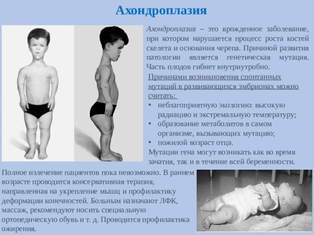 Врожденное заболевание костей. Ахондроплазия генная заболевание. Ахондроплазия Тип наследования аутосомно.