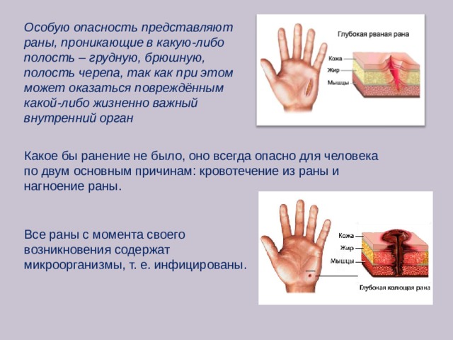 Почему ран. Какие раны представляют особую опасность. Какую опасность представляют р. Опасностями РАН являются. Опасность при открытой ране.
