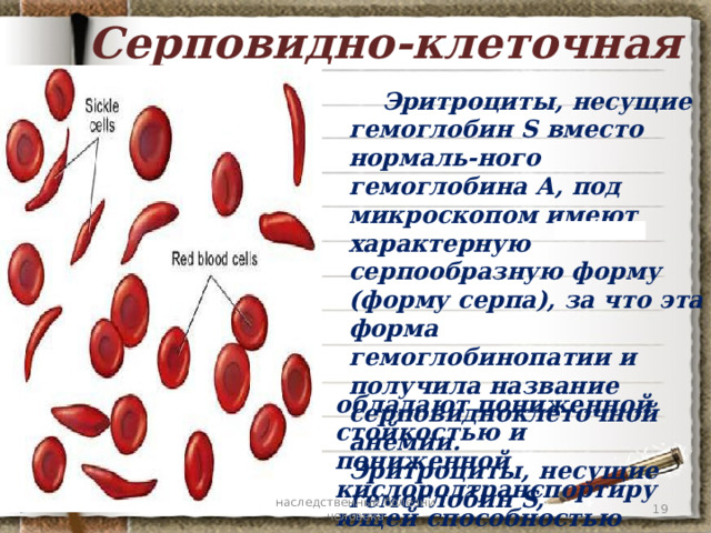 Серповидно-клеточная анемия  Эритроциты, несущие гемоглобин S вместо нормаль-ного гемоглобина А, под микроскопом имеют характерную серпообразную форму (форму серпа), за что эта форма гемоглобинопатии и получила название серповидноклеточной анемии. Эритроциты, несущие гемоглобин S,   обладают пониженной стойкостью и пониженной кислородтранспортирующей способностью  наследственные болезни человека 