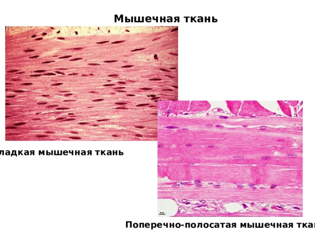 Мышечная ткань Гладкая мышечная ткань Поперечно-полосатая мышечная ткань 