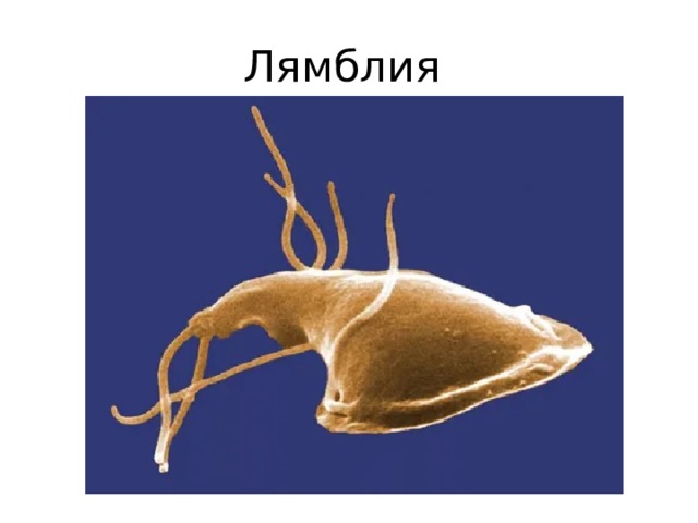 Лямблия 