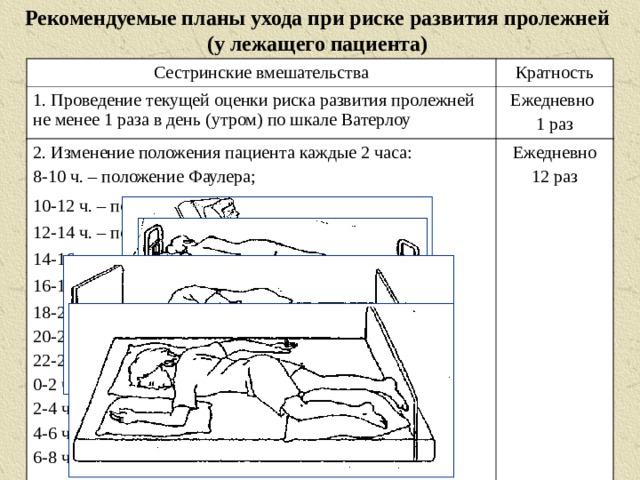 Места образования пролежней у пациента длительной сидящего на кресле тест