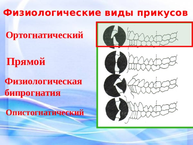 Виды прикусов презентация