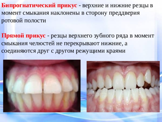 Зубы при закрытом рте. Прикус правильный правильный. Правильный зубной прикус.