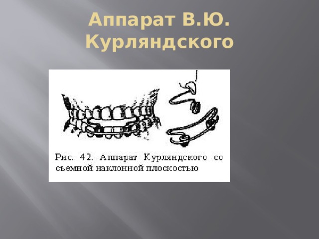 Внеротовые ортодонтические аппараты презентация