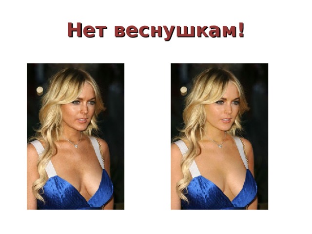 Нет веснушкам! 