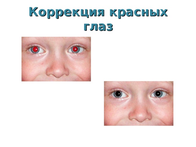 Коррекция красных глаз 