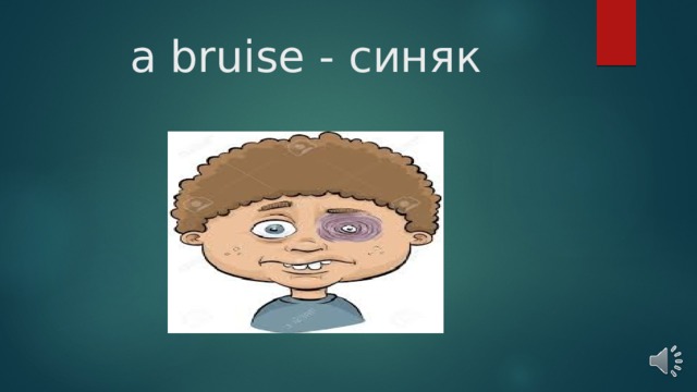 a bruise - синяк   