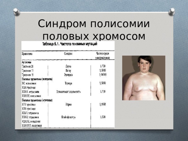 Синдром полисомии половых хромосом 
