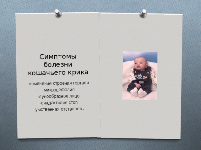 Симптомы болезни кошачьего крика -изменение строения гортани -микроцефалия -лунообразное лицо -синдактилия стоп -умственная отсталость 