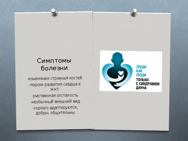 Симптомы болезни -изменения строения костей -пороки развития сердца и ЖКТ -умственная отсталость -необычный внешний вид -хорошо адаптируются, добры, общительны 