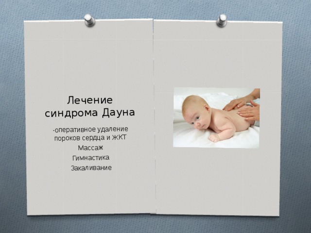 Лечение синдрома Дауна -оперативное удаление пороков сердца и ЖКТ Массаж Гимнастика Закаливание 