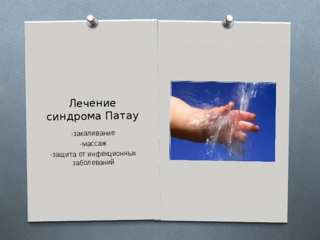 Лечение синдрома Патау -закаливание -массаж -защита от инфекционных заболеваний 