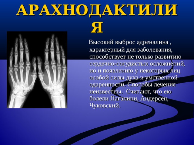 АРАХНОДАКТИЛИЯ  Высокий выброс адреналина , характерный для заболевания, способствует не только развитию сердечно-сосудистых осложнений, но и появлению у некоторых лиц особой силы духа и умственной одаренности. Способы лечения неизвестны. Считают, что ею болели Паганини, Андерсен, Чуковский.  