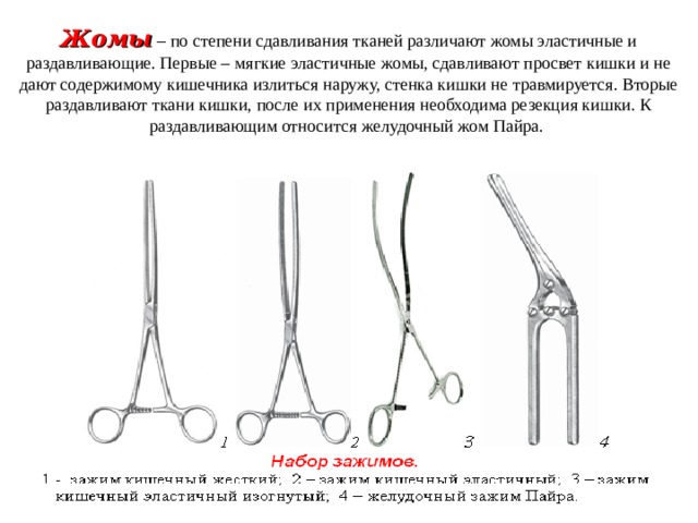 Жомы  – по степени сдавливания тканей различают жомы эластичные и раздавливающие. Первые – мягкие эластичные жомы, сдавливают просвет кишки и не дают содержимому кишечника излиться наружу, стенка кишки не травмируется. Вторые раздавливают ткани кишки, после их применения необходима резекция кишки. К раздавливающим относится желудочный жом Пайра. 