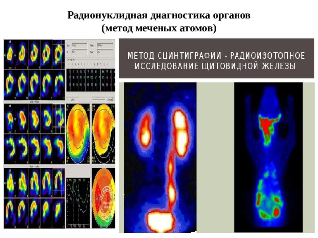 Метод меченых атомов картинки