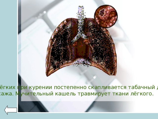 Как выглядят легкие после курения