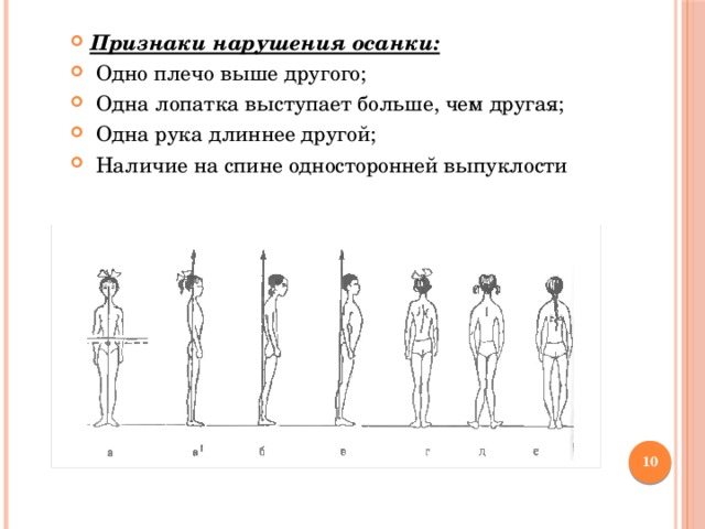 Признаки нарушения осанки:   Одно плечо выше другого;   Одна лопатка выступает больше, чем другая;   Одна рука длиннее другой;  Наличие на спине односторонней выпуклости  