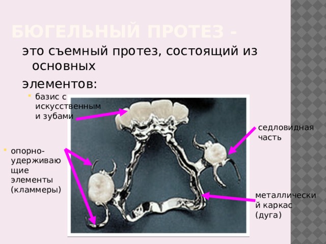Бюгельный протез - это съемный протез, состоящий из основных элементов: базис с искусственными зубами седловидная часть опорно-удерживающие элементы (кламмеры) металлический каркас (дуга) 