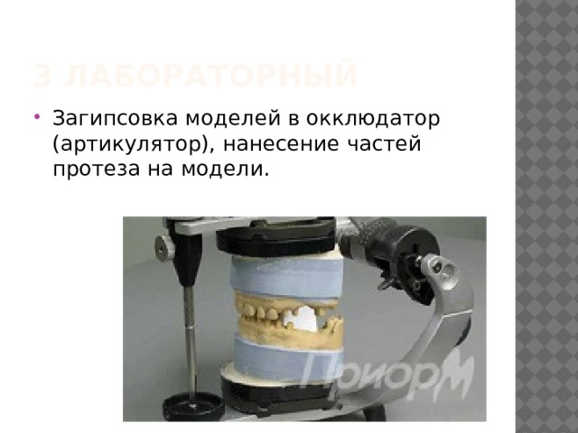 3 лабораторный Загипсовка моделей в окклюдатор (артикулятор), нанесение частей протеза на модели. 