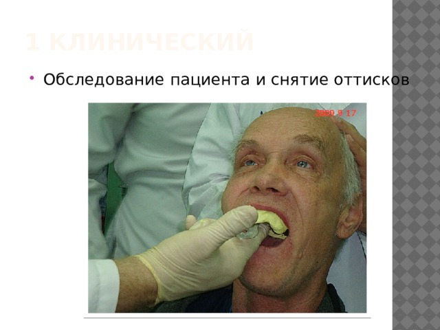 1 клинический Обследование пациента и снятие оттисков 