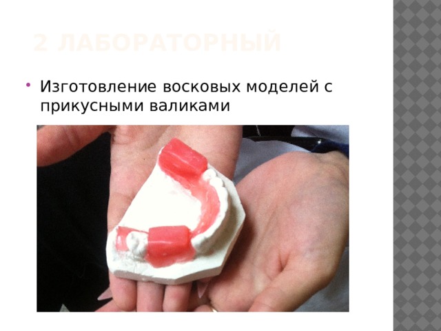 2 лабораторный Изготовление восковых моделей с прикусными валиками 